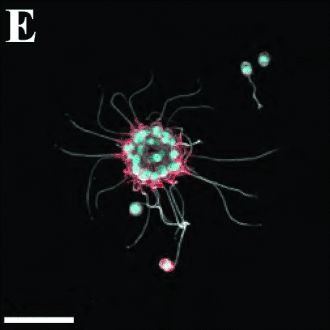 Kleine Kolonie von B. monosierra (Durch­messer 19 µm). Balken: 20 µm.