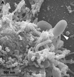 Ein Partikel von Alphaorpheovirus massiliense (Pfeil), bereits im Kontakt mit einer Wirtszelle (Vermamoeba vermiformis)