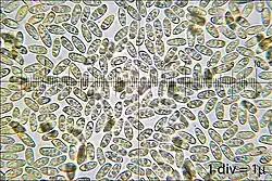 Sporen des Gold-Röhrlings im Lichtmikroskop