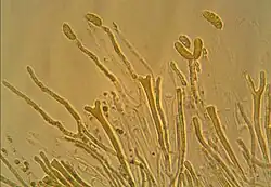 Mikroskopaufnahme der Fruchtschicht der Riesen-Gallertträne