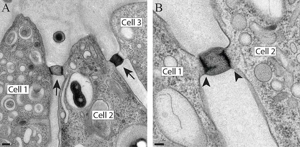 TEM-Detailaufnahmen der interzellulären Brücken zwischen den Choanozyten einer Kolonie von B. monosierra