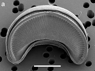 REM-Aufnahme von E. pelagica UHM3200. Balken: 5 µm.