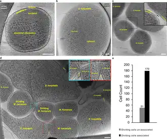 Cryo-ET-Aufnahmen von Ca. S. hospitalis und Ca. M. harzensis.