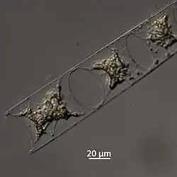 H. membranaceus in Formalin, geprobt im November 2015, Expedition der Polarstern.