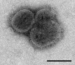 Drei Virionen des Bourbon-Virus in der sphärischen Form