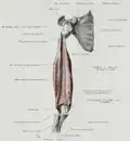 Innenseite des Musculus triceps brachii nach Wegnahme des Humerus. Atypischer Insertionszipfel des Caput mediale am Epicondylus medialis humeri.