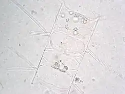 Chaetoceros cf. lorenzianus