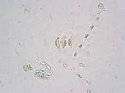 LM-Aufnahme von C. wighamii Brightwell