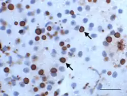 Immunhisto­chemisches Präparat der Bauchspeichel­drüse einer Boa constrictor mit BIBD: EK dunkelrot mit monoklonalen Anti-IBD-Protein-Antikörpern gefärbt (Pfeile), Zellkerne blau gegengefärbt, Balken 20 µm (L.-W. Chang et al. 2013).