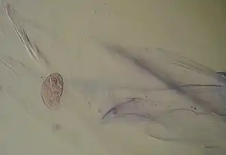 Wimpertierchen (Colpoda sp.) und Zwiebelhaut