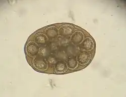 Paket von Gurkenkernbandwurm-Eiern (Mikroskopische Aufnahme)