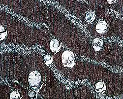 Holz der Maulbeerfeige (Ficus sycomorus) mit Axialparenchym (lichtmikroskopische Aufnahme)