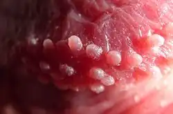 Detailaufnahme von Hornzipfelchen