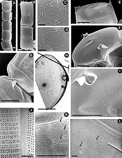 Cerataulina pelagica [C. bergonii]