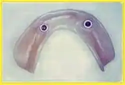 Die dazu passende Unterkiefer-Prothese mit den eingearbeiteten Matrizen