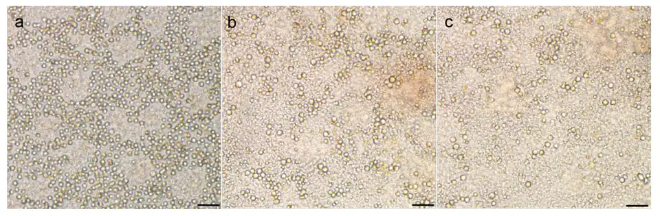 Zellen im Ruhestadium (RSCs) von A. anophagefferens Stamm CCMP1984 nach längerer Lagerung (von l. nach r.: 1, 2 und 3 Monate); Balken 10 µm.[1]