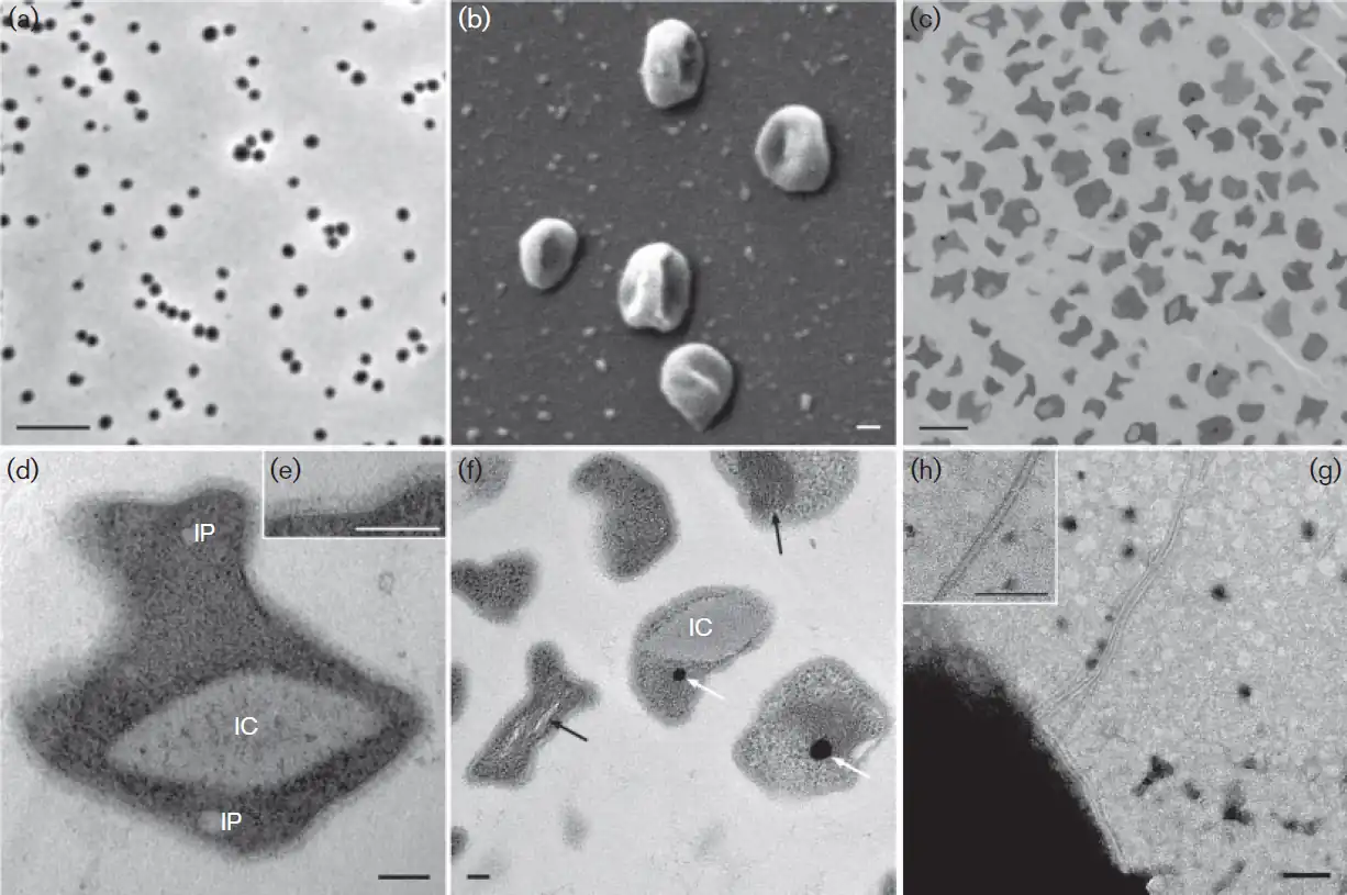 (a) Phasenkontrastbild; Balken: 5 µm. (b) REM-Aufnahme mehrerer Zellen mit unregelmäßig-kokkoider Form; Balken: 100 nm. (c–f) TEM-Aufnahmen von Ultradünnschnitten chemisch fixierter Zellen von EN76ᵀ: 00(c) Übersichtsaufnahme mit unregelmäßiger Zellform; Balken: 1 µm. 00(d,e) Vergrößerte Zelle mit intrazellulären Merkmalen, 00(d,e) darunter deutlich erkennbar ein potentielles intrazelluläres Kompartiment (IC) und Einlagerungen (IP) 00(d,e) Das Inset (e) zeigt Zellmembran, Pseudoperiplasma & S-Layer mit stärkerer Vergrößerung; Balken: 100 nm. 00(f) Potentielles IC, hervorgehoben: tubulusartige Strukturen (weiße Pfeile) & elektronendichte Partikel; Balken: 100 nm. (g,h) TEM-Aufnahmen einer Zelle mit Archaellum; das Inset (h) zeigt das vergrößerte Archaellum; Balken: 100 nm. Zu den Begrifflichkeiten der Zellanatomie siehe Ignicoccus §Membransystem.