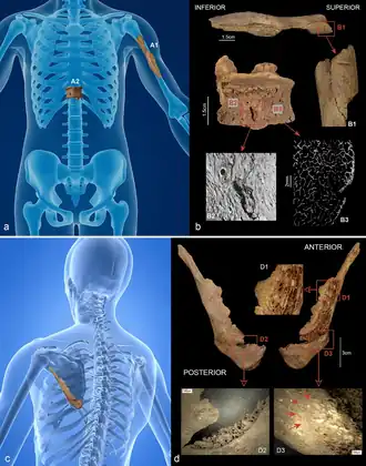 Rekonstruktion der Verletzungen