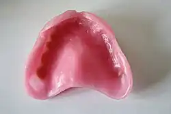 Oberkiefer-Totalprothesenbasis aus Wachs modelliert zur Einprobe