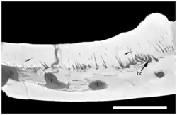CT-Aufnahme eines Unterkieferknochens in Seitenansicht