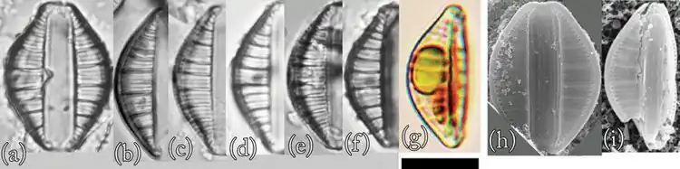 E. operculata: (a–g) LM- und (h,i) REM-Aufnahmen. Balken: 10 μm.