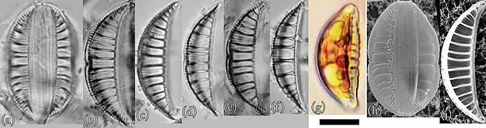 E. sp. „Akan“: (a–g) LM- und (h,i) REM-Aufnahmen. Balken: 10 μm.