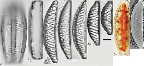 E. turgida: (a–h) LM- und (i) REM-Aufnahmen. Balken: 10 μm.