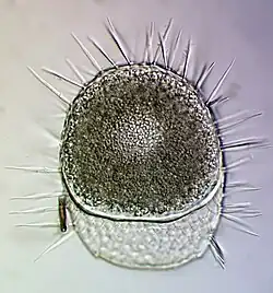 Placocista spinosa, eine Euglyphida aus dem Ahlenmoor