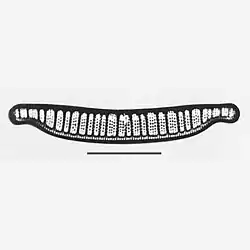 E. adnata var. porcellus [E. zebra var. porcellus]. Balken: 25 µm.