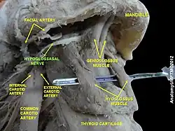 Anatomisches Präparat mit freigelegtem Nervus hypoglossus