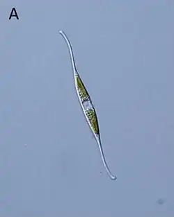 LM-Ansicht von Nitzschia reversa