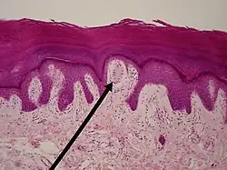 Ein Meissner-Körperchen (Spitze des schwarzen Zeigers) im Lichtmikroskop. Seine Lokalisation im Stratum papillare des Coriums ist gut zu erkennen.