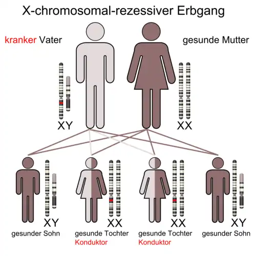 X-chromosomal-rezessiver Erbgang (bei krankem Vater)