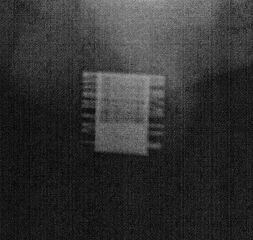 Ein Röntgenbild des implantierten ZSI 375. Das Gerät wird aktiviert – die Feder wird oben am Zylinder dekomprimiert. Der Patient ist kontinent.