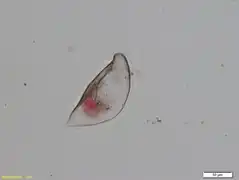 Cyphoderia calceola [C. calceolus]