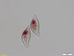 Cyphoderia trocha [C. trochus]