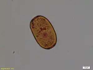 Amphitrema flavum, Mikrophotographie